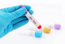 Same Day HIV Test Dubai: Ensuring Fast, Reliable, and Private Results