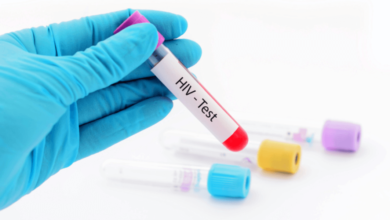 Same Day HIV Test Dubai: Ensuring Fast, Reliable, and Private Results