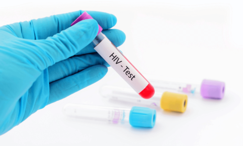 Same Day HIV Test Dubai: Ensuring Fast, Reliable, and Private Results